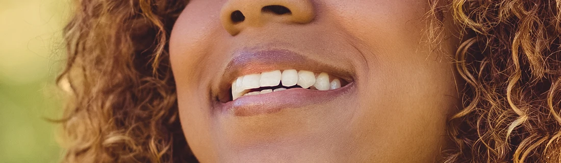 Dentist Flower Mound TX FAQs A close-up of a person with warm-toned skin and curly brown hair, highlighting their healthy, white teeth.